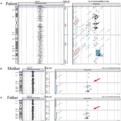 Case Report: First Case of Non-restrictive Ventricular Septal Defect With Congestive Heart Failure in a Chinese Han Male Infant Carrying a Class II Chromosome 17p13.3 Microduplication